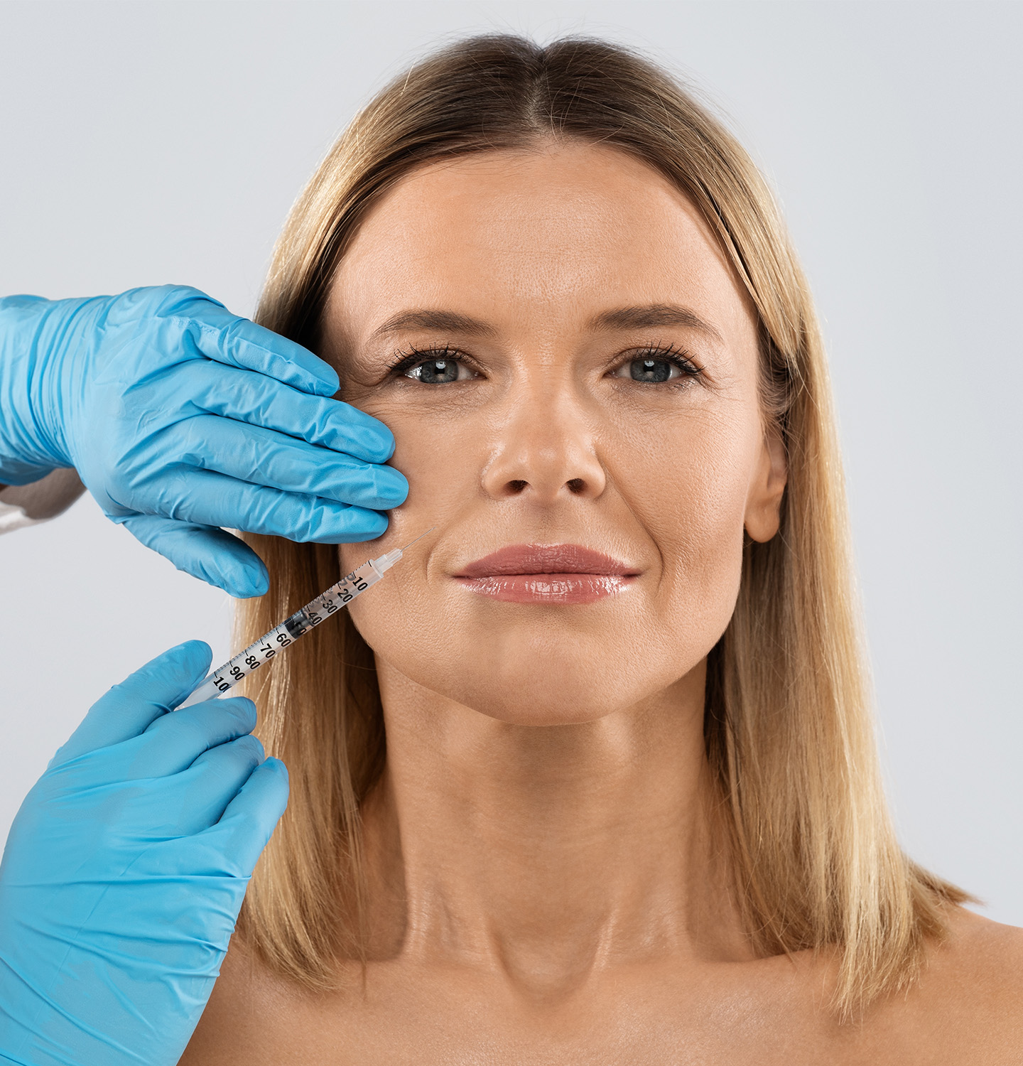 botox_long_beach_ca image Hyaluronic Acid Dermal Fillers
